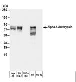 Human Alpha-1-Antitrypsin Polyclonal Antibody