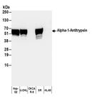 Human Alpha-1-Antitrypsin Polyclonal Antibody, HRP