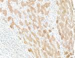 Human C-Reactive Protein (CRP) Polyclonal Antibody