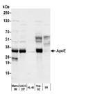 ApoE Polyclonal Antibody, Biotin