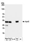 ApoE Polyclonal Antibody, HRP