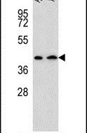 AADAT Antibody in Western Blot (WB)