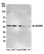 AAGAB Polyclonal Antibody