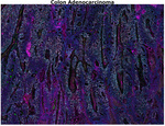 PD-1 (CD279) Antibody in Immunohistochemistry (Paraffin) (IHC (P))