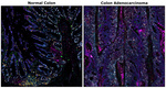 PD-1 (CD279) Antibody in Immunohistochemistry (Paraffin) (IHC (P))