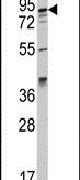 AAK1 Antibody in Western Blot (WB)