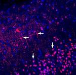 Adenosine A2A Receptor (extracellular) Polyclonal Antibody