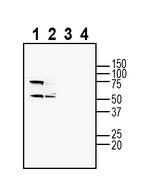 Adenosine A1 Receptor (extracellular) Antibody in Western Blot (WB)