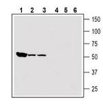 Renin Receptor/ATP6AP2 (extracellular) Antibody in Western Blot (WB)