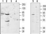 alpha 1B-Adrenergic Receptor (extracellular) Antibody in Western Blot (WB)