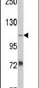AASS Antibody in Western Blot (WB)