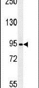 AASS Antibody in Western Blot (WB)
