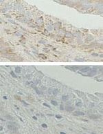 ERAB Antibody in Immunohistochemistry (IHC)