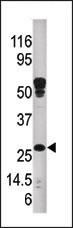 ERAB Antibody in Western Blot (WB)