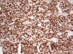 ABAT Antibody in Immunohistochemistry (Paraffin) (IHC (P))