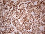 ABAT Antibody in Immunohistochemistry (Paraffin) (IHC (P))