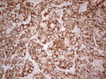ABAT Antibody in Immunohistochemistry (Paraffin) (IHC (P))
