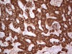 ABAT Antibody in Immunohistochemistry (Paraffin) (IHC (P))