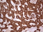 ABAT Antibody in Immunohistochemistry (Paraffin) (IHC (P))
