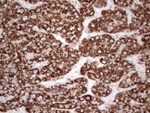 ABAT Antibody in Immunohistochemistry (Paraffin) (IHC (P))