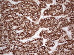 ABAT Antibody in Immunohistochemistry (Paraffin) (IHC (P))