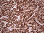 ABAT Antibody in Immunohistochemistry (Paraffin) (IHC (P))