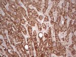 ABAT Antibody in Immunohistochemistry (Paraffin) (IHC (P))