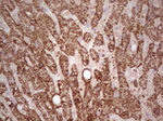 ABAT Antibody in Immunohistochemistry (Paraffin) (IHC (P))