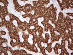 ABAT Antibody in Immunohistochemistry (Paraffin) (IHC (P))