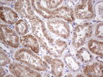 ABAT Antibody in Immunohistochemistry (Paraffin) (IHC (P))