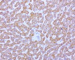 ABAT Antibody in Immunohistochemistry (Paraffin) (IHC (P))