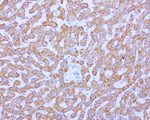 ABAT Antibody in Immunohistochemistry (Paraffin) (IHC (P))