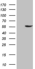 ABAT Antibody in Western Blot (WB)