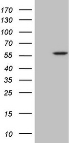ABAT Antibody in Western Blot (WB)
