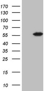 ABAT Antibody in Western Blot (WB)