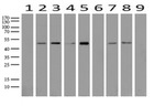 ABAT Antibody in Western Blot (WB)