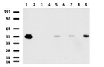 ABAT Antibody in Western Blot (WB)
