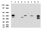ABAT Antibody in Western Blot (WB)