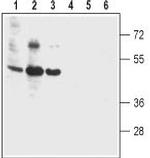 Bestrophin-2 (extracellular) Antibody in Western Blot (WB)