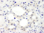 ABC2 Antibody in Immunohistochemistry (IHC)