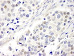 ABC2 Antibody in Immunohistochemistry (IHC)