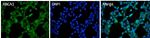 ABCA1 Polyclonal Antibody, DyLight™ 488