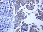 ABCB1 Antibody in Immunohistochemistry (Paraffin) (IHC (P))