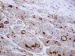 ABCB1 Antibody in Immunohistochemistry (Paraffin) (IHC (P))