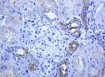 ABCB1 Antibody in Immunohistochemistry (Paraffin) (IHC (P))