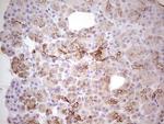 ABCB1 Antibody in Immunohistochemistry (Paraffin) (IHC (P))