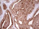 ABCB1 Antibody in Immunohistochemistry (Paraffin) (IHC (P))