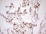 ABCB1 Antibody in Immunohistochemistry (Paraffin) (IHC (P))