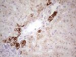 ABCB1 Antibody in Immunohistochemistry (Paraffin) (IHC (P))