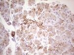 ABCB1 Antibody in Immunohistochemistry (Paraffin) (IHC (P))